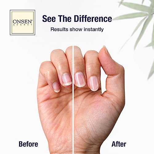 Onsen Secret Complete Nail Reboot Kit w/Nail Reboot Oil 10ml, Nail File 120/180 Grit Double Sided, A 3-Way Nail Buffer Block & Cuticle Serum-15ml w/Cuticle Oil in Action-Super Value Pack