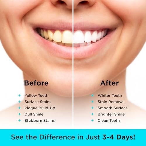 CARBON WHITE Teeth Whitening Powder - Natural Activated Coconut Charcoal Tooth Powder for Removing Stains & Discoloration - Helps Fight Tartar & Plaque, Freshens Breath - Tasteless, Odorless - 30g