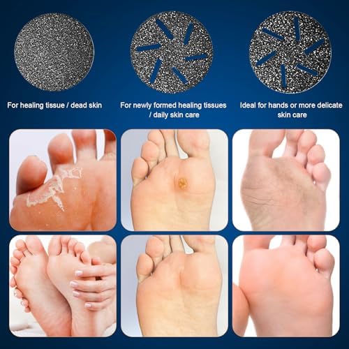 Electric Foot Callus Remover, IPX7 Waterproof Pedicure Kit Rechargeable Calloused Feet Remover Tool with LCD Display, 2-Speed Dual Motors for Efficient Exfoliation of Dead Skin on Feet