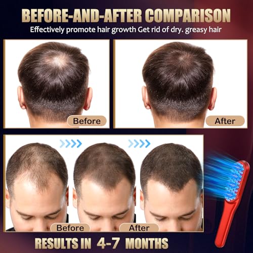 Laser Hair Growth Comb，Red Light Hair Growth Treatment for Men & Women（Red 1pcs ）