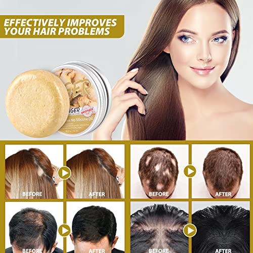 Ginger Hair Regrowth Shampoo Bar, Natural Organic Ginger Shampoo Soap for Anti Hair Loss,dandruff,itching, Promotes Hair Growth, 5 Pack (2 Fl Oz each)