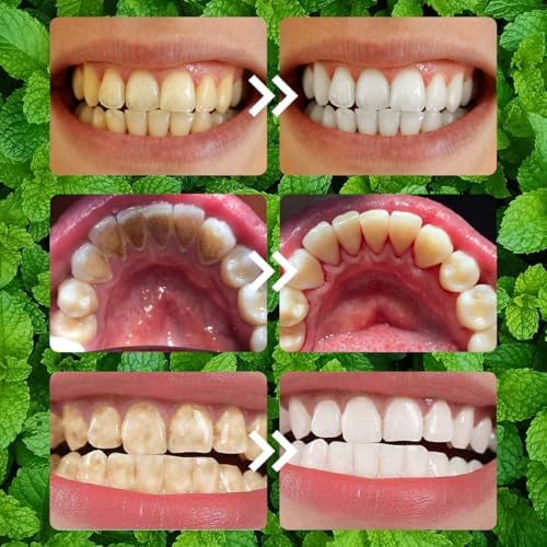 2PCS Teeth Restoration Mineral Powder, Mineral Tooth Powder, Teeth Whitening Mineral, Effective in Strengthening Teeth and Gums for Daily Use (50g/1.76 oz)