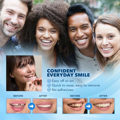 Imako Premium Cosmetic Uppers - 1 Pack - Large, Bleached White - Custom Fit at Home, DIY Smile Makeover, Made in USA