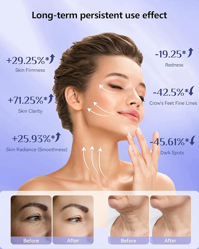 LED Red Light Therapy Mask, 630nm & 830nm Wavelength LED Light Therapy Device for Home Use (White)