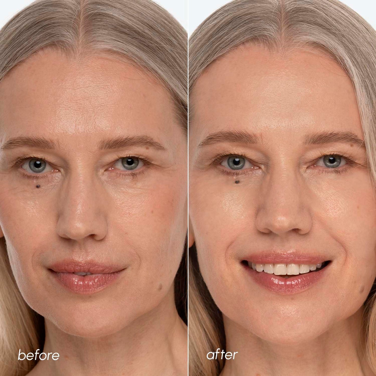 Glycolic Acid Facial Peel | 2-Pack Toner Polishes with Tea Tree Oil & Vitamins