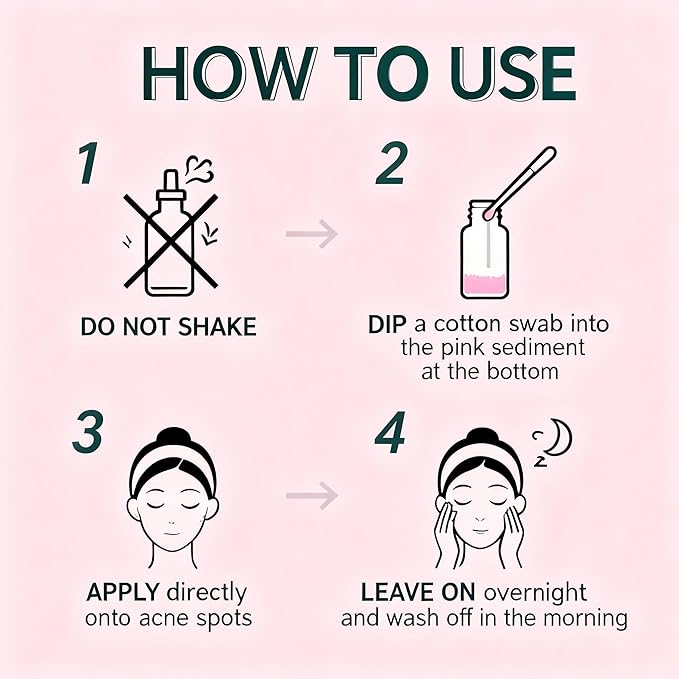 Premium Acne Spot Drying Lotion Kit with Swab, Overnight Acne Treatment For Face, Dry Out Pimples, Blemishes, Zits And Clean Pores, 12ml / 0.41 FlOz