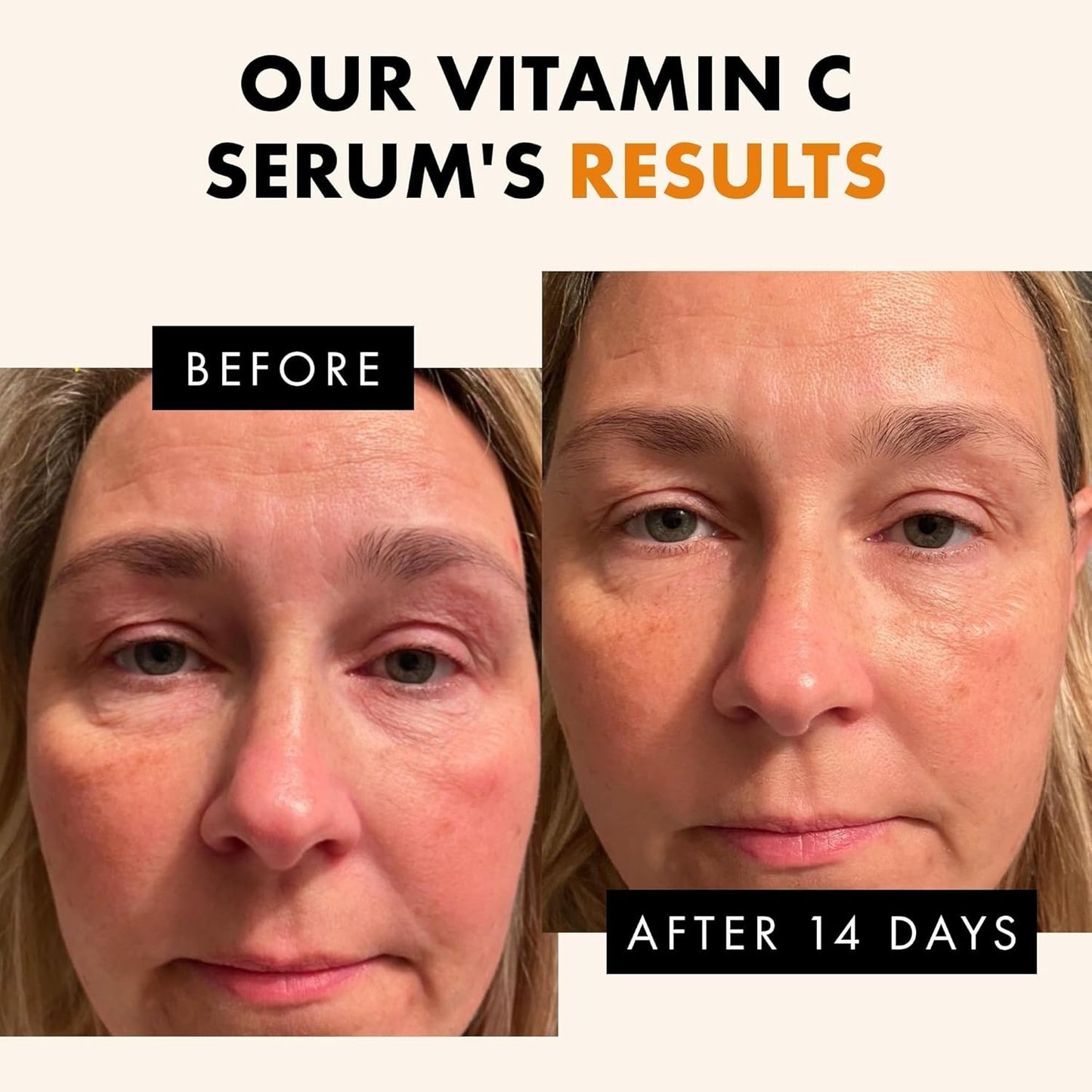 Vitamin C Face Serum | Anti-Aging & Skin Brightening | 30ml | Eclat Skincare