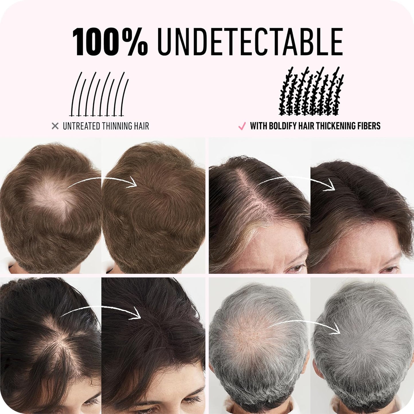 BOLDIFY Hair Fibers 12g | Dark Gray | Thinning Hair Solution for Men & Women