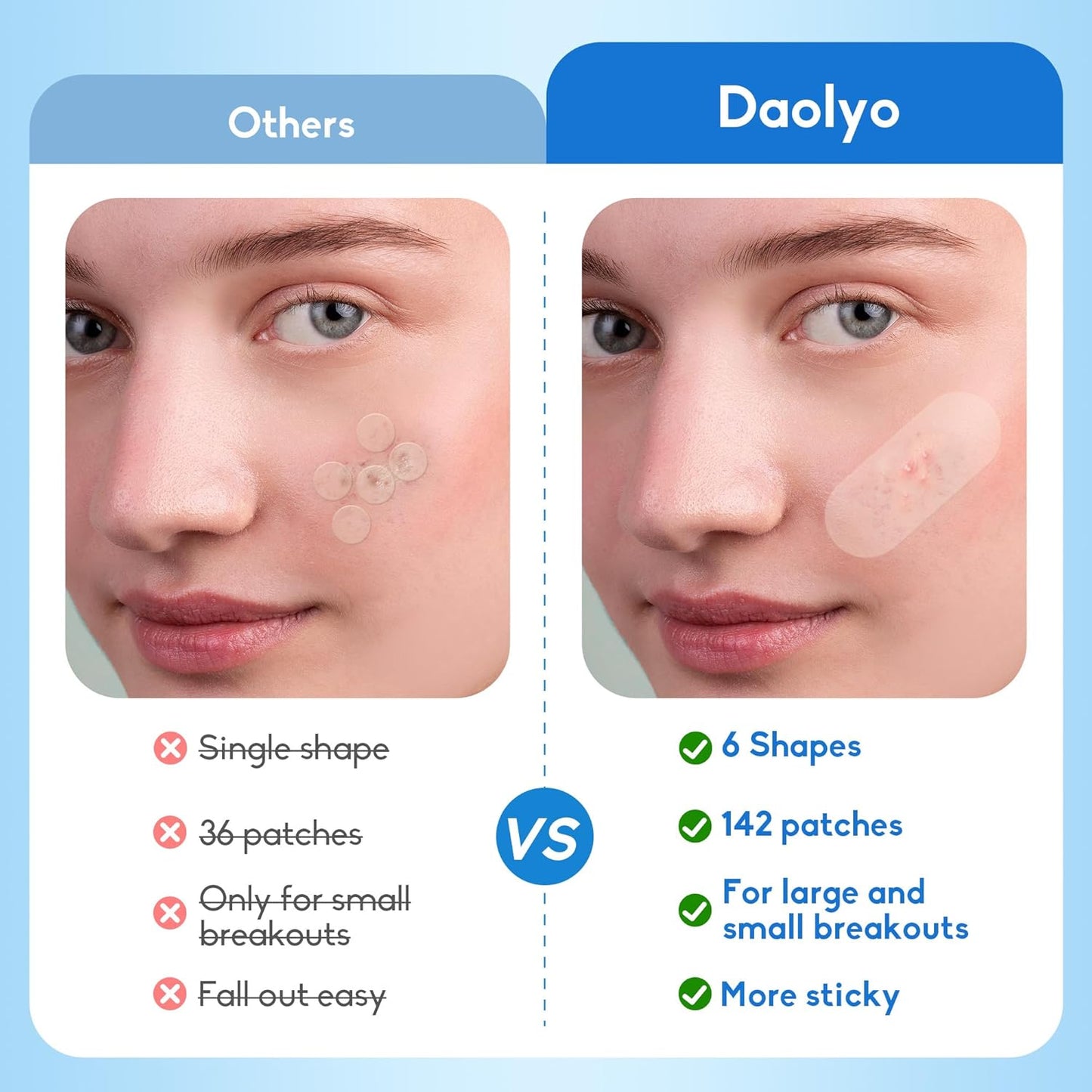 Large Hydrocolloid Acne Pimple Patches | 142 Count | 6 Sizes for Face & Body