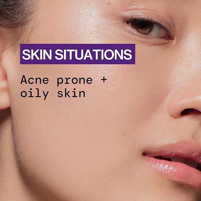 Pacifica Acne Spot Treatment & Pimple Cream – Dry It Out Gel with 2% Salicylic Acid, Witch Hazel, Niacinamide – Dries Blemishes Overnight, Fights Breakouts & Redness, For Teens & Adults, Vegan Clean