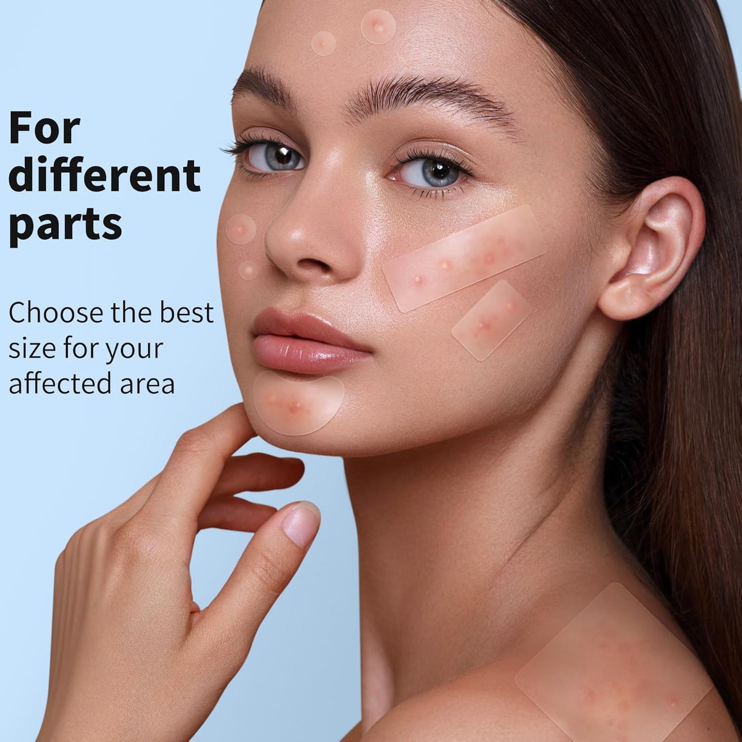 Large Hydrocolloid Acne Pimple Patches | 142 Count | 6 Sizes for Face & Body