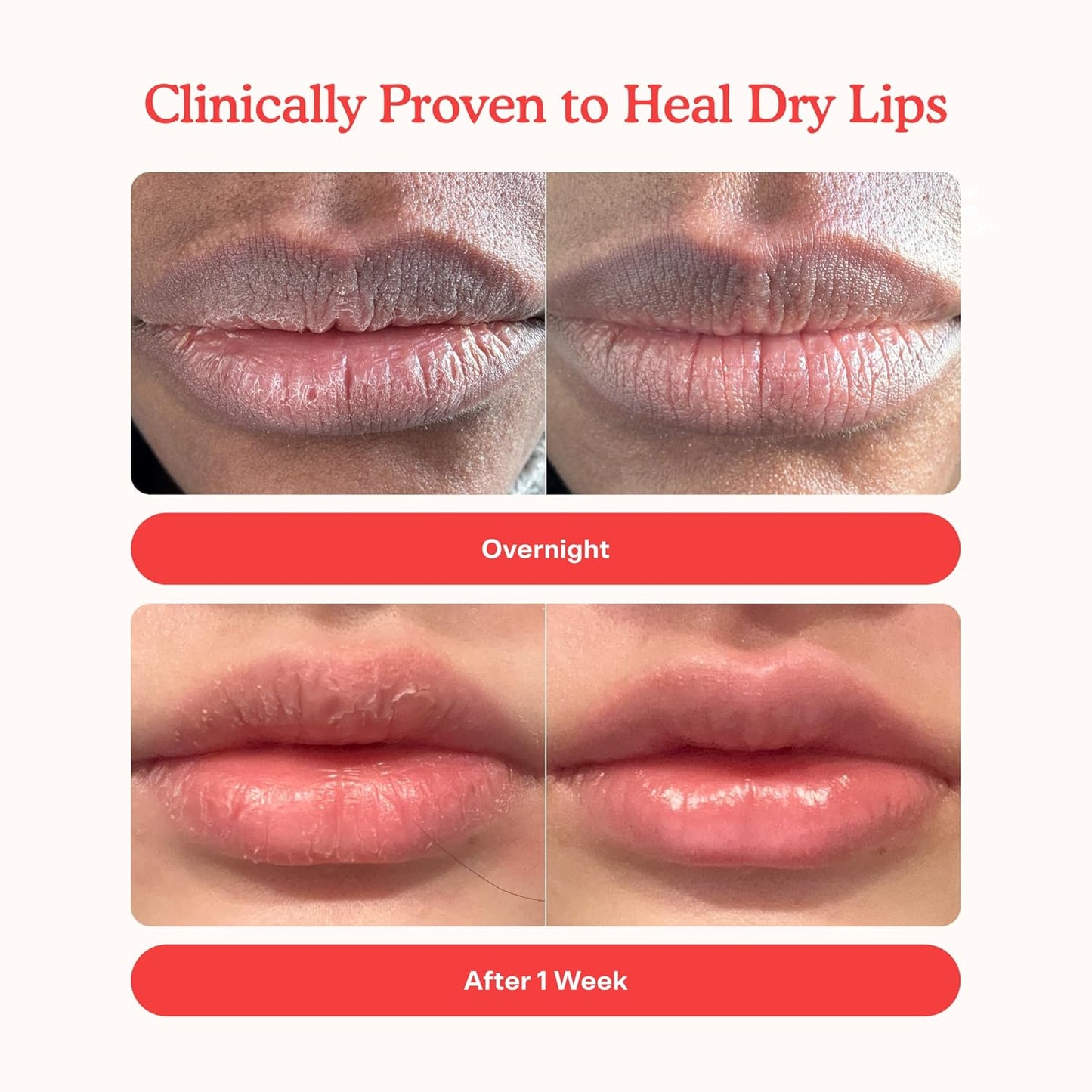 Tower 28 LipSoftie Hydrating Tinted Lip Treatment Balm, Moisturizing Lip Mask for Chapped Lips - Red Bean Mochi, Sheer Rosy Nude