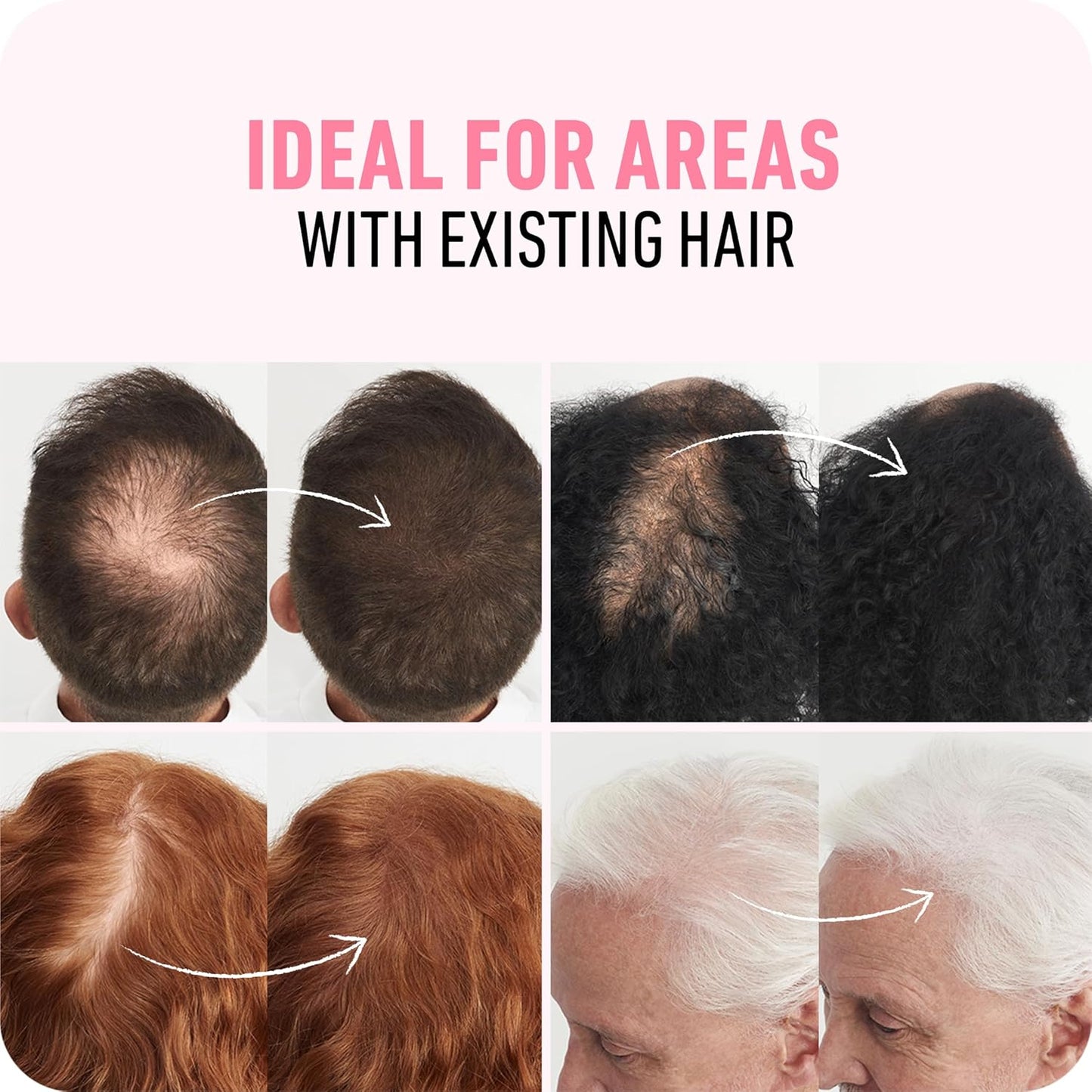 BOLDIFY Hair Fibers 28g | Thinning Hair Solution | Ash Brown for Men & Women