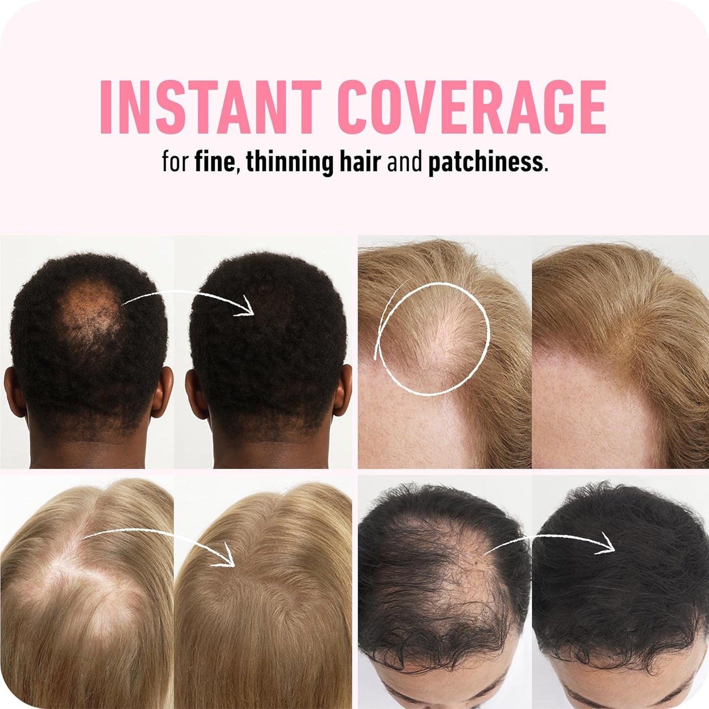BOLDIFY Hair Fibers 12g | Dark Gray | Thinning Hair Solution for Men & Women
