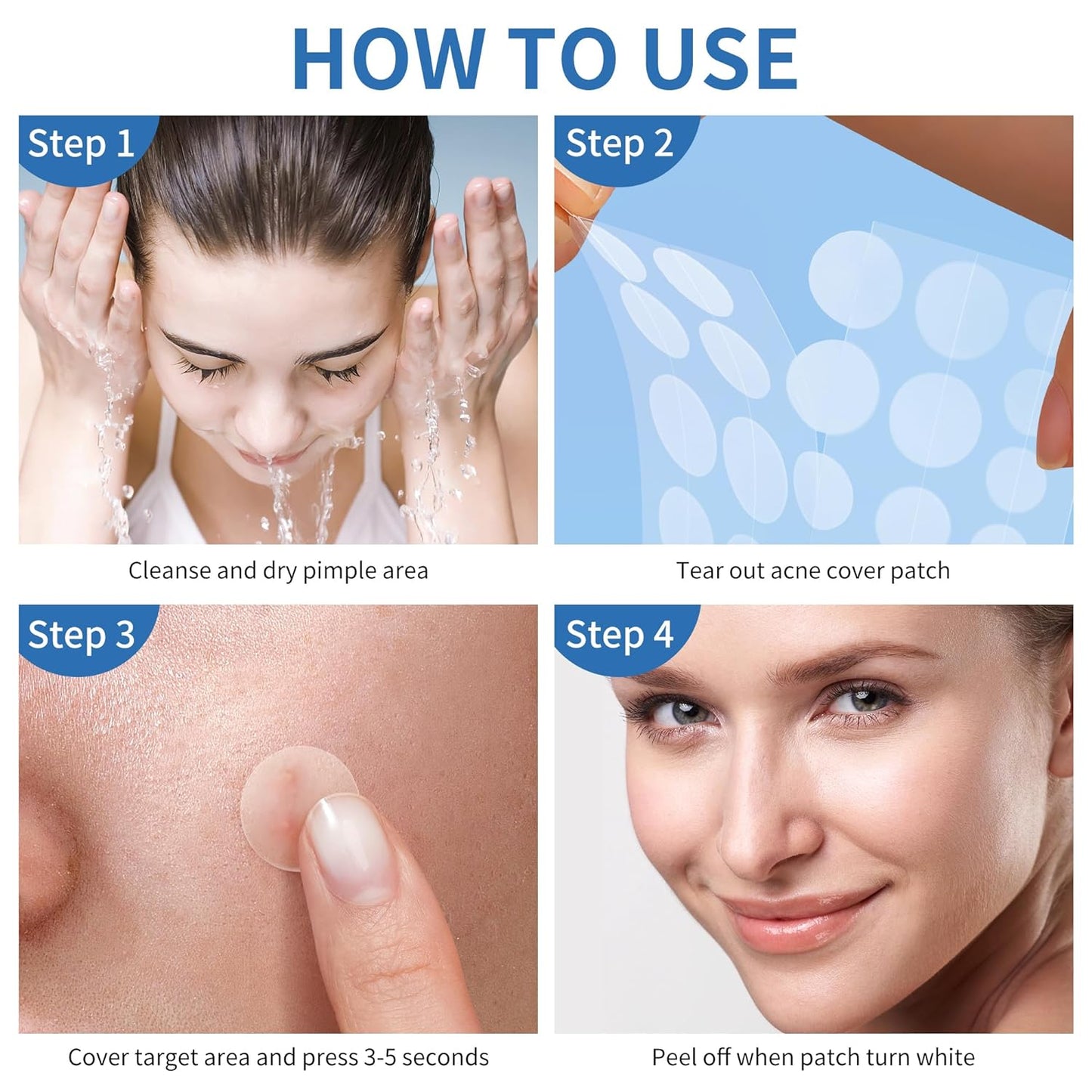 Hydrocolloid Acne Patches | 300 Count | Salicylic Acid & Tea Tree Oil
