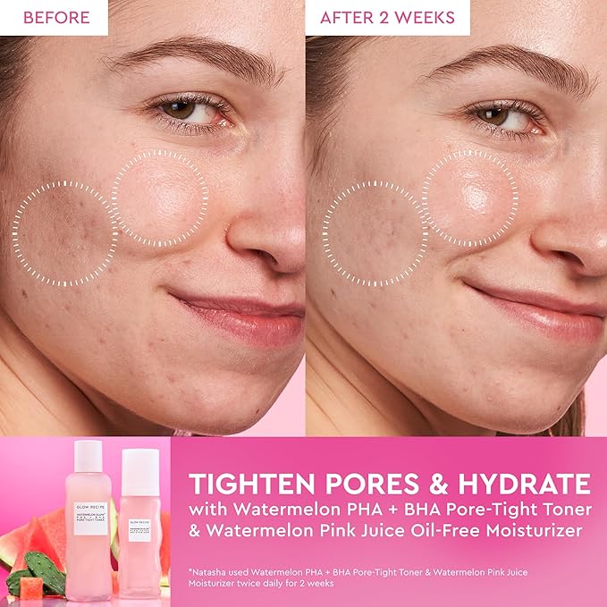 Glow Recipe PHA + BHA Face Toner - Korean Skin Care Pore Minimizer & Gentle Facial Exfoliator for Tightening, Hydrating & Exfoliating - Glycerin, Watermelon & Cactus Water (40ml)