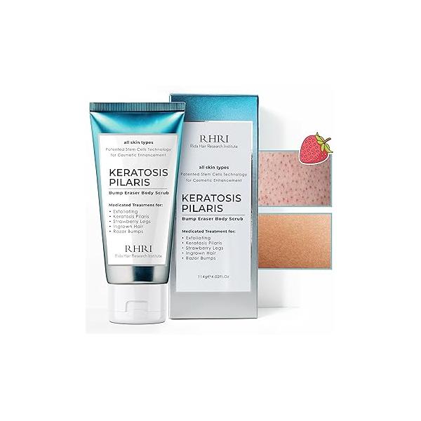 KP Bump Eraser Body Scrub | Keratosis Pilaris Treatment Exfoliating Scrun Ingrown Hair Clears Strawberry Legs Soothes Redness, Dryness & Flaky Skin