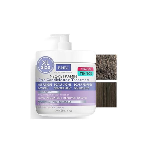 Anti Fungal Shampoo for Men & Women | Dandruff, Medicated, Folliculitis Dry Scalp, Psoriasis, Ringworm Itchy, Flaky Irritated Scalp No Paraben Sulphate w/Scrubber Brush